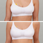 Medela SOLO™ HANDS-FREE Μονό Ηλεκτρικό Θήλαστρο 2-Phase Expression® 101045514